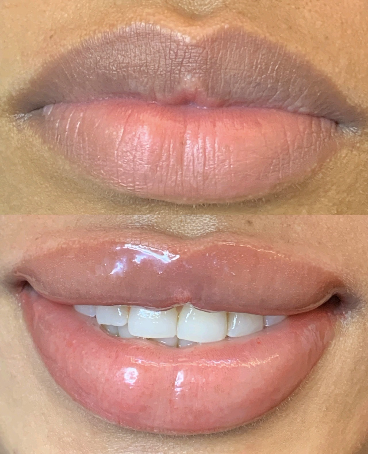 Micropigmentación Labios